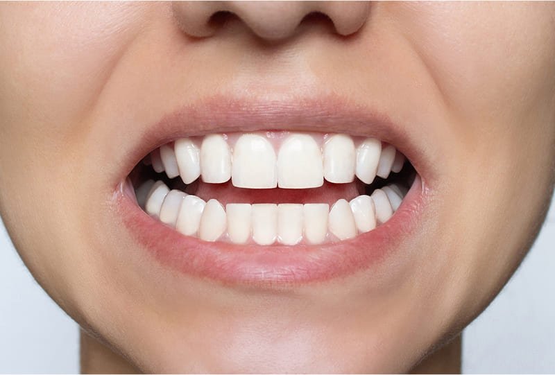 Depois: Ana Luísa, 28 anos - São Paulo/SP