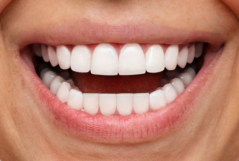 Depois: Carlos Henrique, 34 anos - Ribeirão Preto/SP