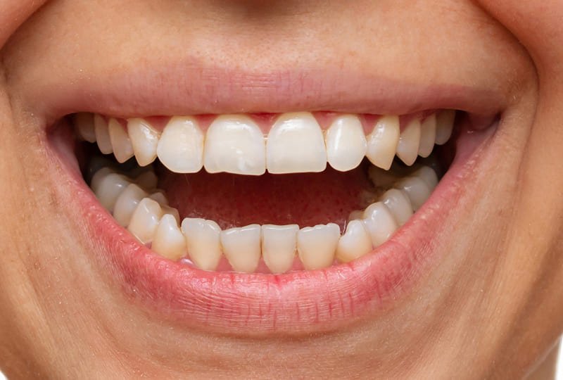 Antes: Carlos Henrique, 34 anos - Ribeirão Preto/SP