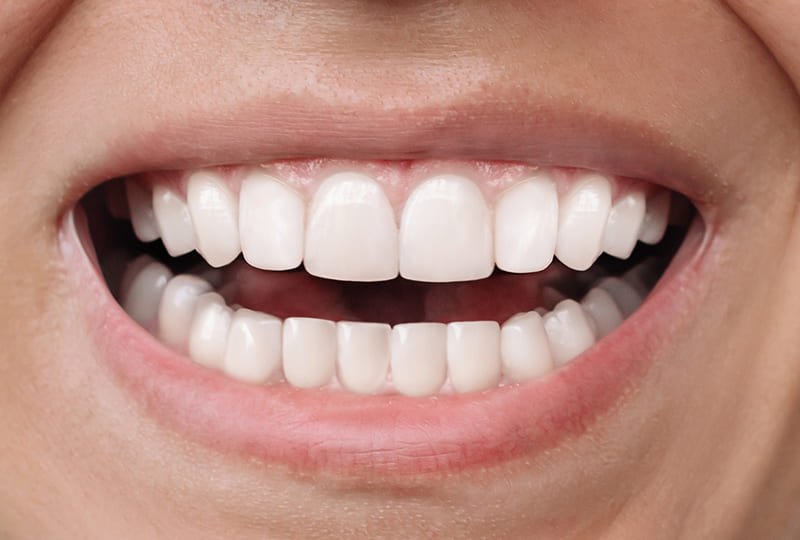 Depois: Juliana Ribeiro, 25 anos - Curitiba/PR