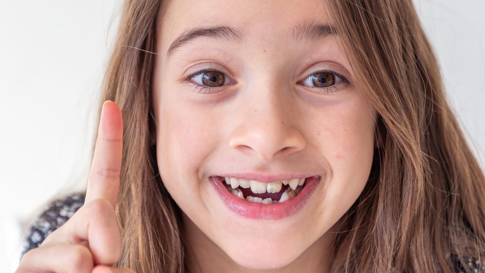 Alinhadores invisíveis funcionam para adolescentes