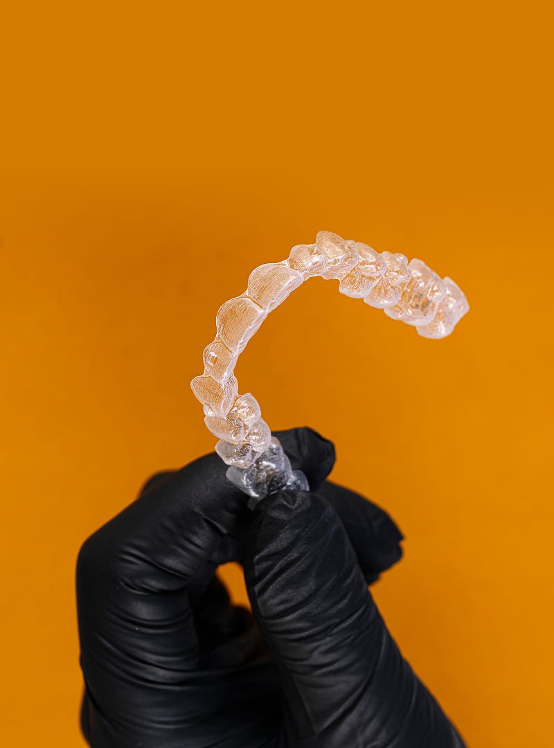 Sobremordida (overbite)